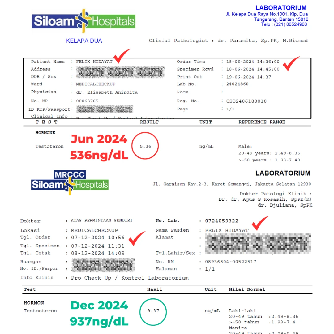Two Siloam Hospitals laboratory reports for Felix Hidayat Lim, June 2024 and December 2024